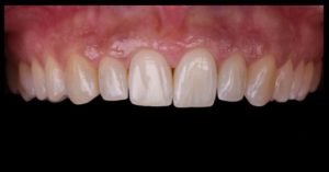 Principios Básicos en Fotografía Clínica