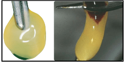 Figura 1: Izquierda PRGF, Derecha L-PRP