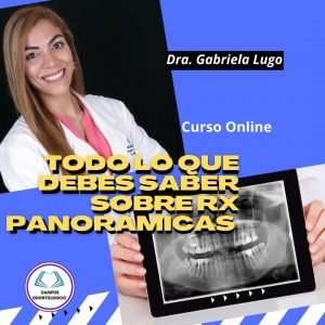 Curso Todo lo que debes Saber sobre Rx Panorámica